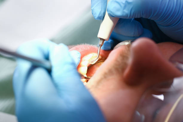 Best Chipped Tooth Repair Near Me  in Huntington Bay, NY